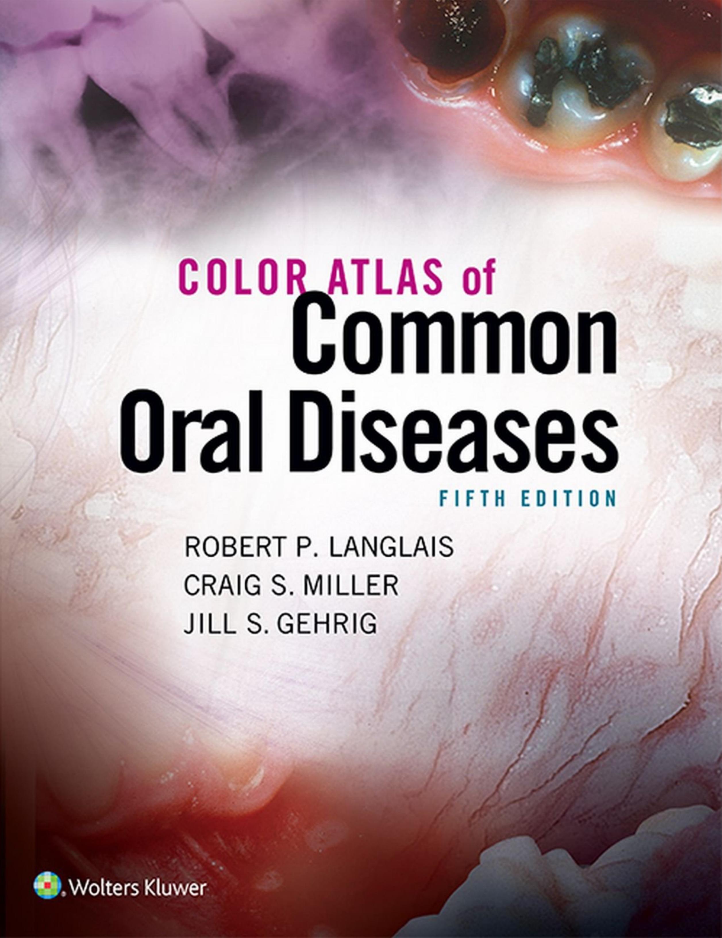 Color Atlas of Common Oral Diseases by Robert Langlais Craig Miller