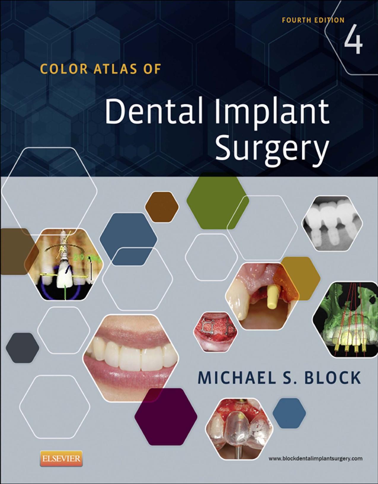 Color Atlas of Dental Implant Surgery, 4e by Michael S. Block DMD
