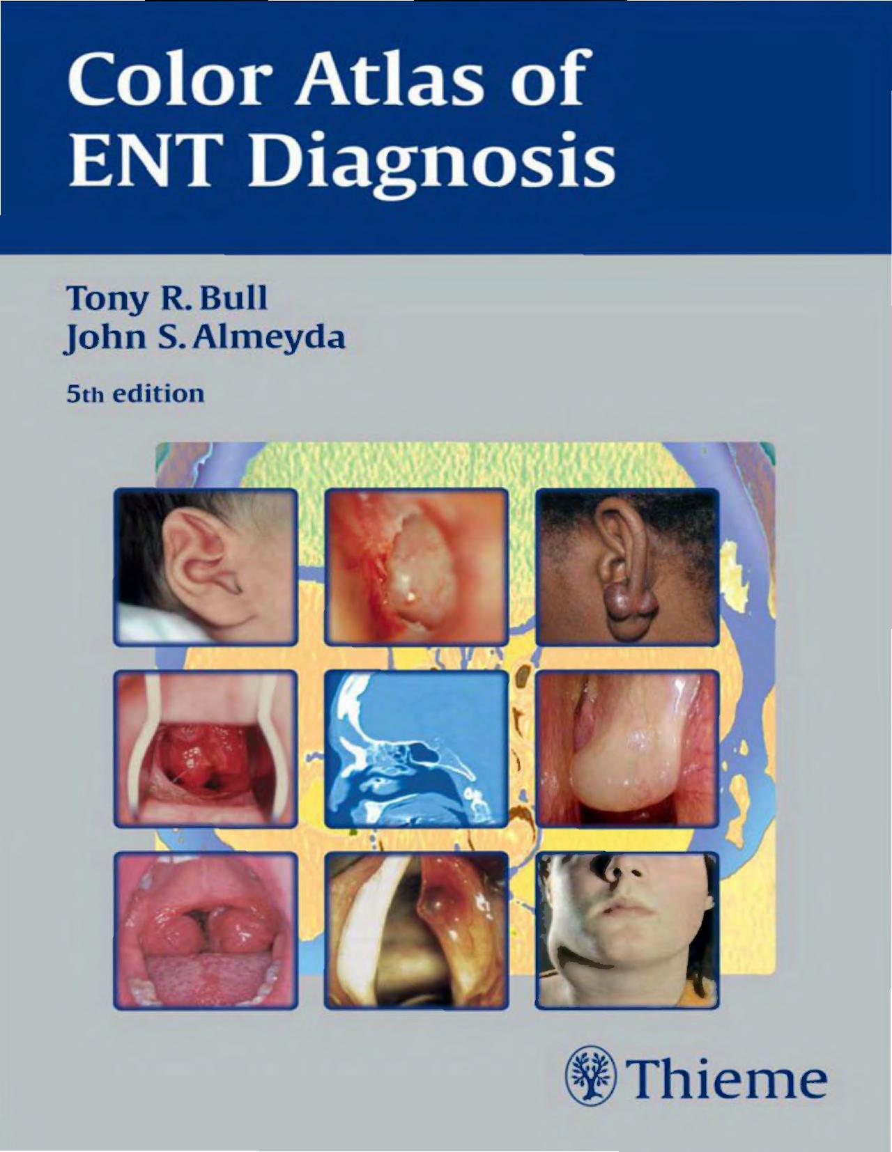 Color Atlas of ENT Diagnosis by Tony R. Bull John S. Almeyda