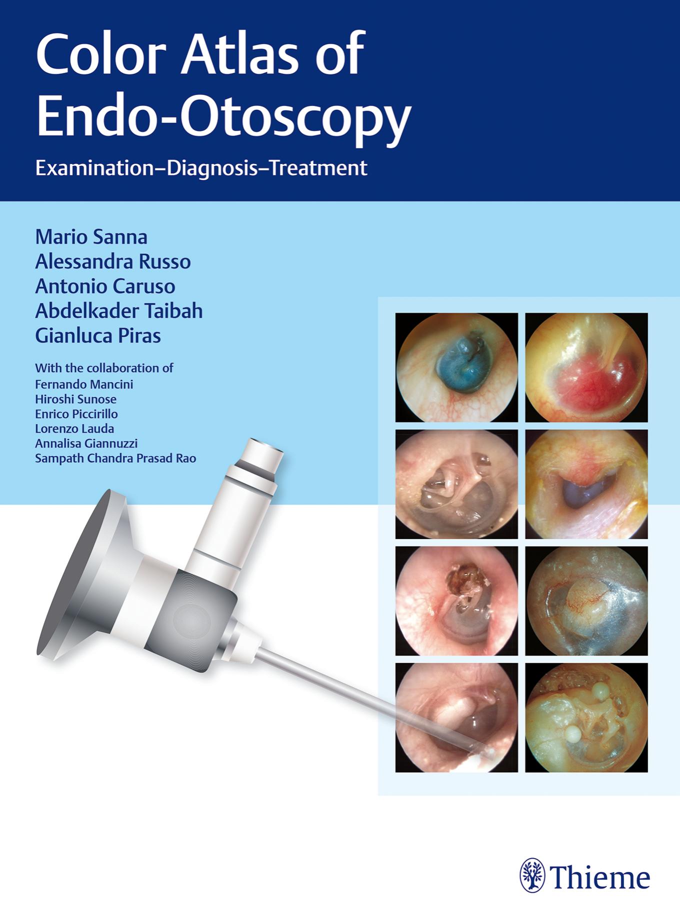 Color Atlas of Endo-Otoscopy : Examination-Diagnosis-Treatment by Mario Sanna and Alessandra Russo