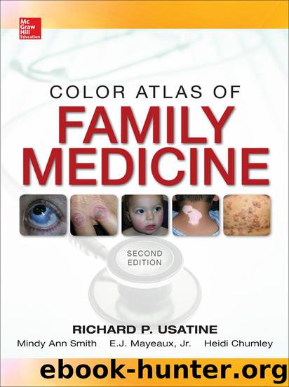 Color Atlas of Family Medicine 2E by Richard Usatine & Mindy Ann Smith & Mayeaux Jr. E.J. & Heidi Chumley