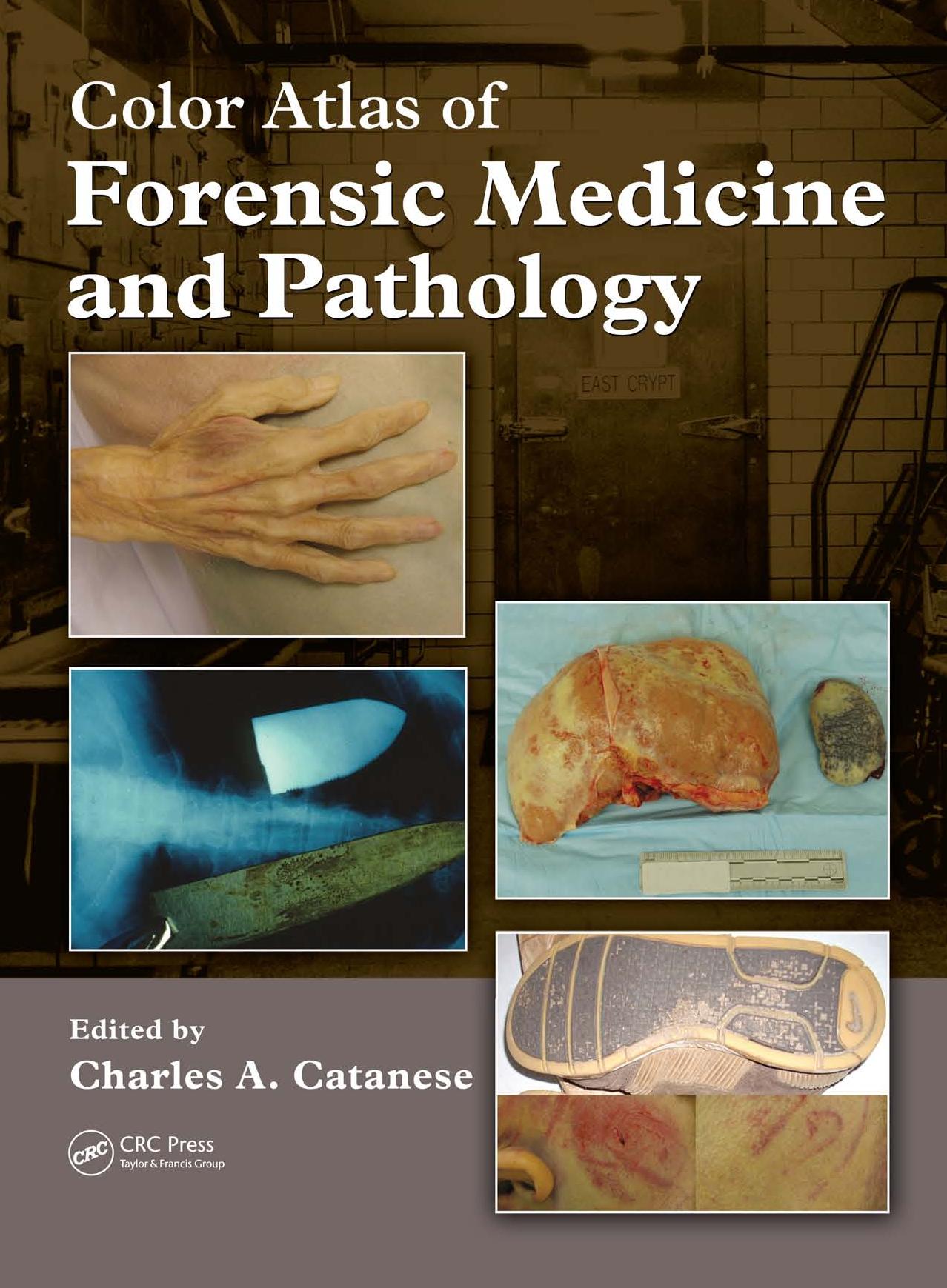 Color Atlas of Forensic Medicine and Pathology by Charles A. Catanese