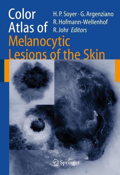 Color Atlas of Melanocytic Lesions of the Skin by Hans Peter Soyer Giuseppe Argenziano Rainer Hofmann-Wellenhof Robert H. Johr