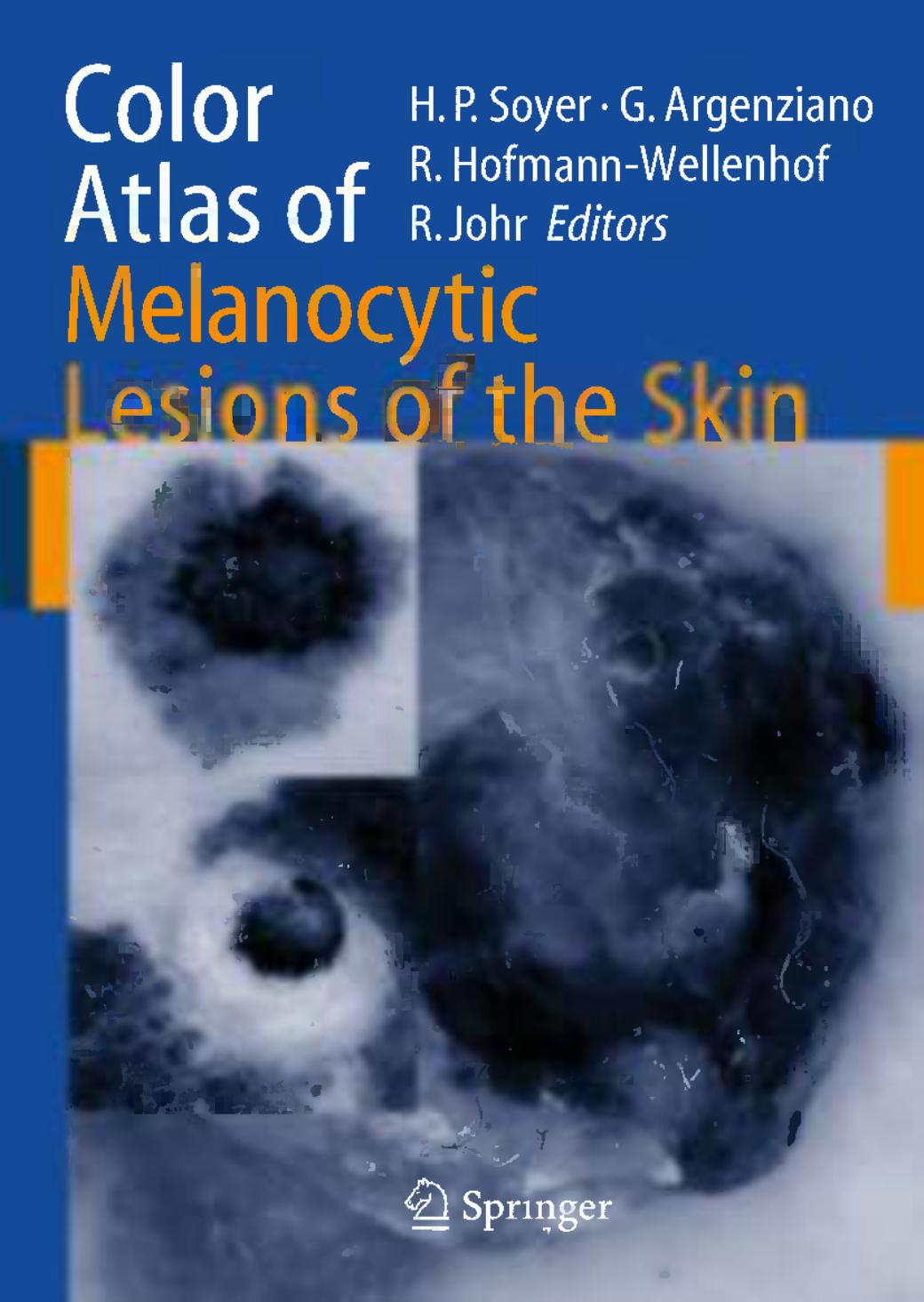 Color Atlas of Melanocytic Lesions of the Skin by Hans Peter Soyer Guiseppe Argenziano Rainer Hofmann-Wellenhof Robert H. Johr (eds.)