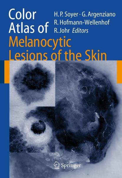 Color Atlas of Melanocytic Lesions of the Skin by Soyer H.P. (ed.) Argenziano G. (ed.)