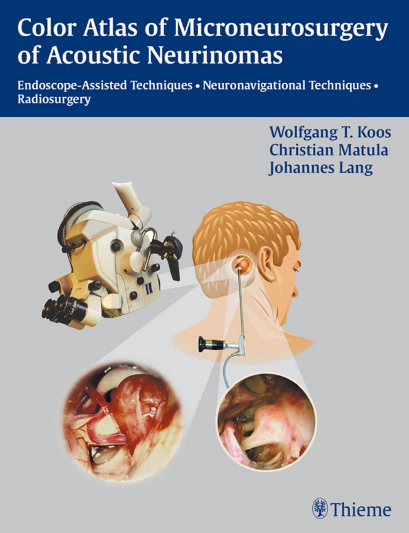 Color Atlas of Microsurgery of Acoustic Neurinomas: Endoscope-Assisted Techniques - Neuronavigational Techniques - Radiosurgery by W. Koos and Christian Matula
