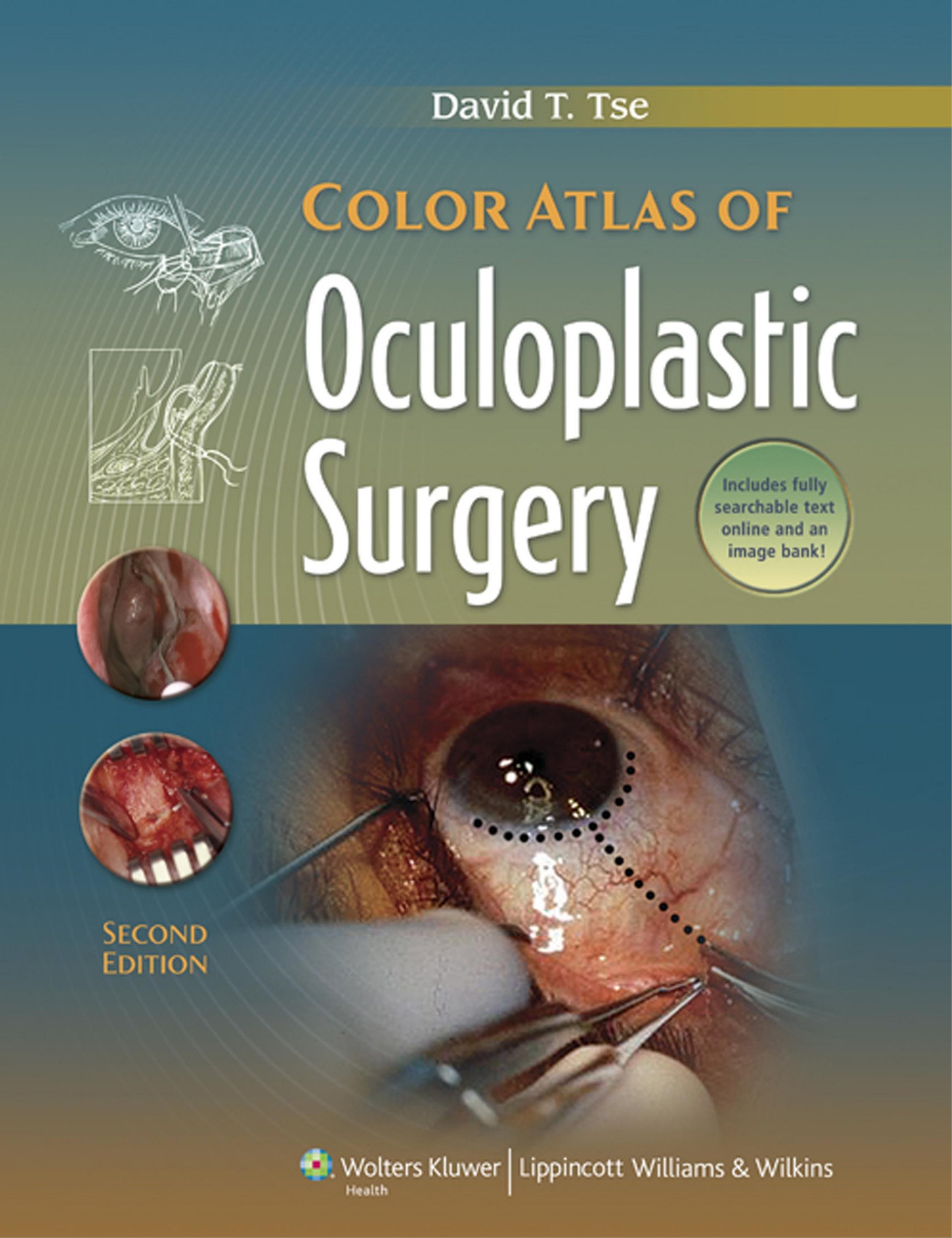 Color Atlas of Oculoplastic Surgery by David T. Tse MD
