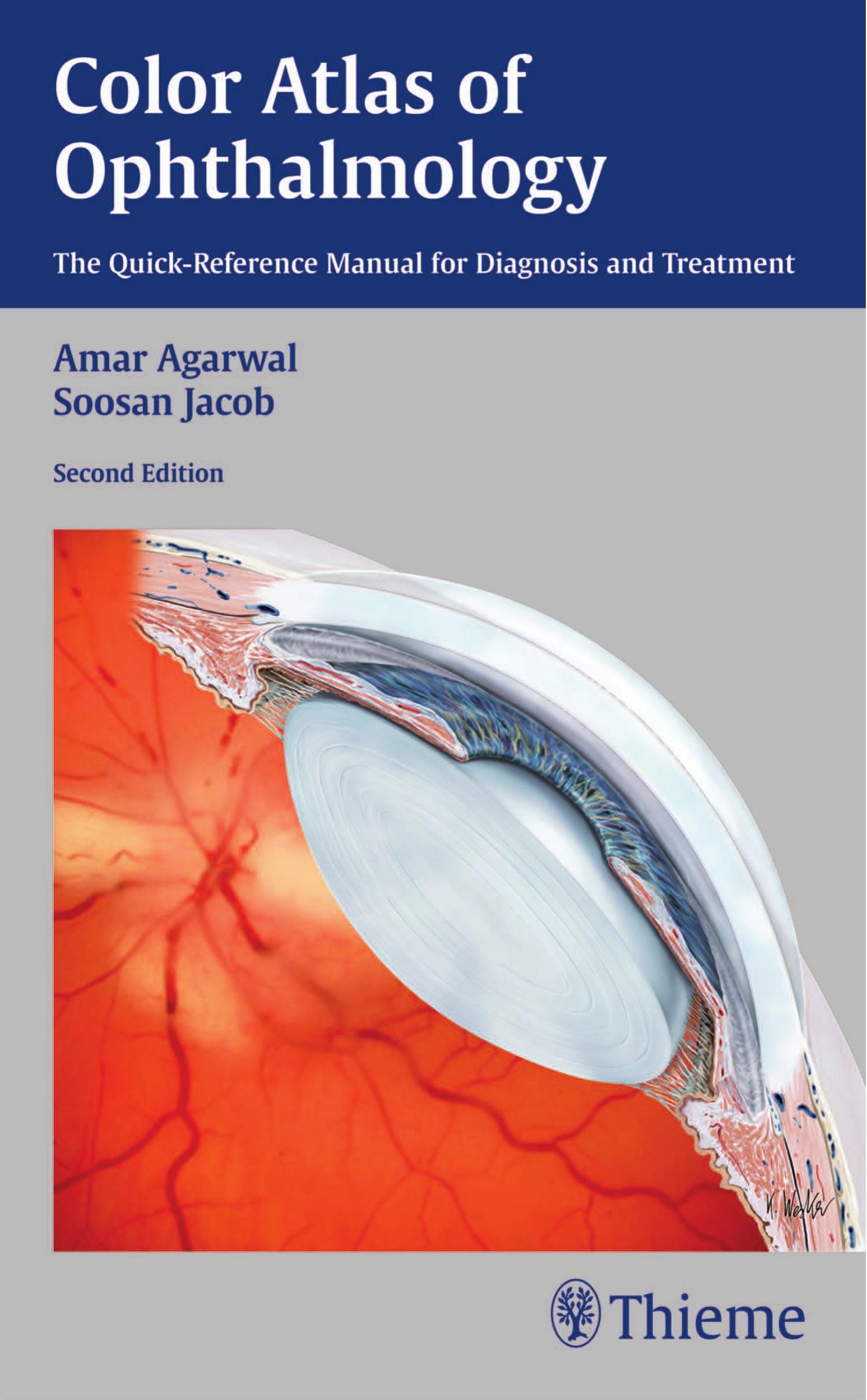 Color Atlas of Ophthalmology: The Quick-Reference Manual for Diagnosis and Treatment by Amar Agarwal Soosan Jacob
