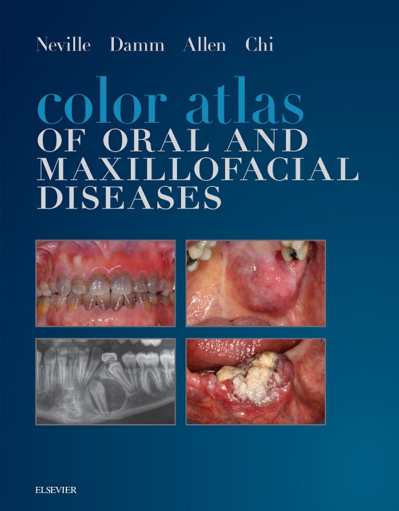 Color Atlas of Oral and Maxillofacial Diseases by Brad W Neville; Douglas D Damm; Carl M Allen; Angela C Chi