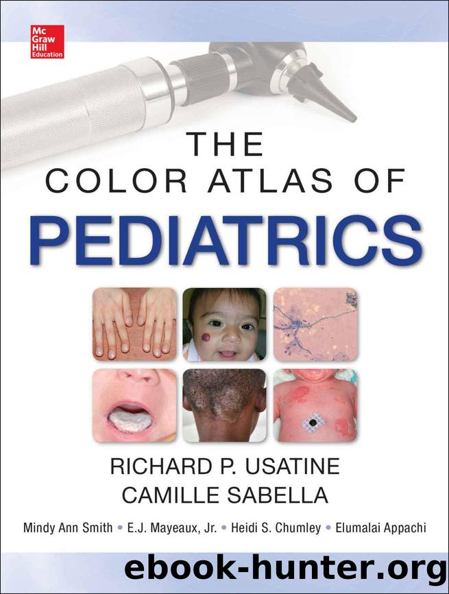 Color Atlas of Pediatrics by Richard Usatine & Camille Sabella