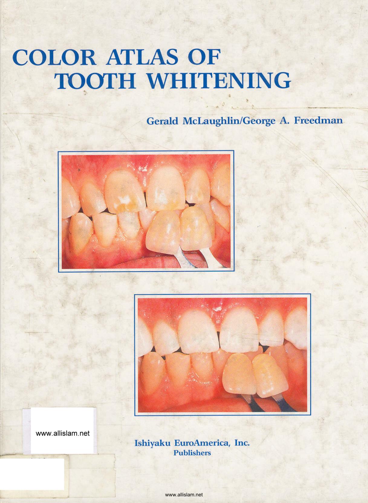 Color Atlas of Tooth Whitening by Unknown