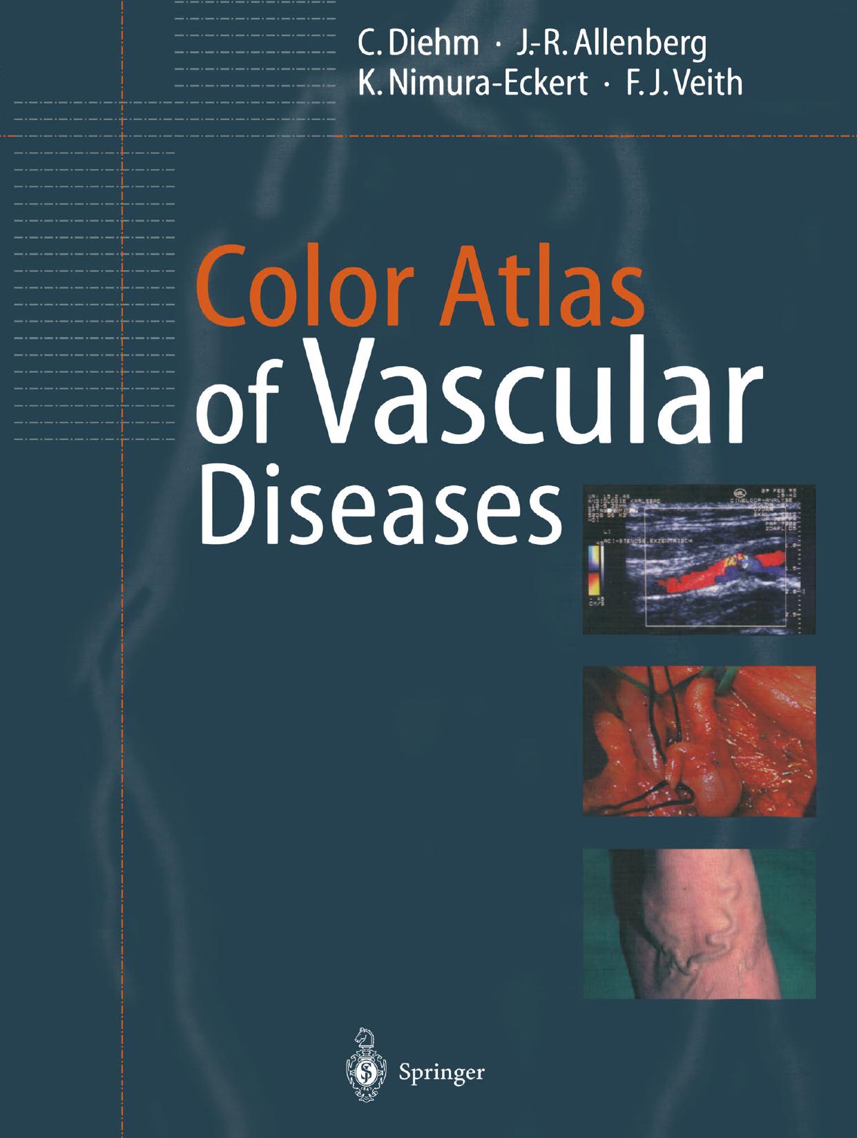 Color Atlas of Vascular Diseases by unknow