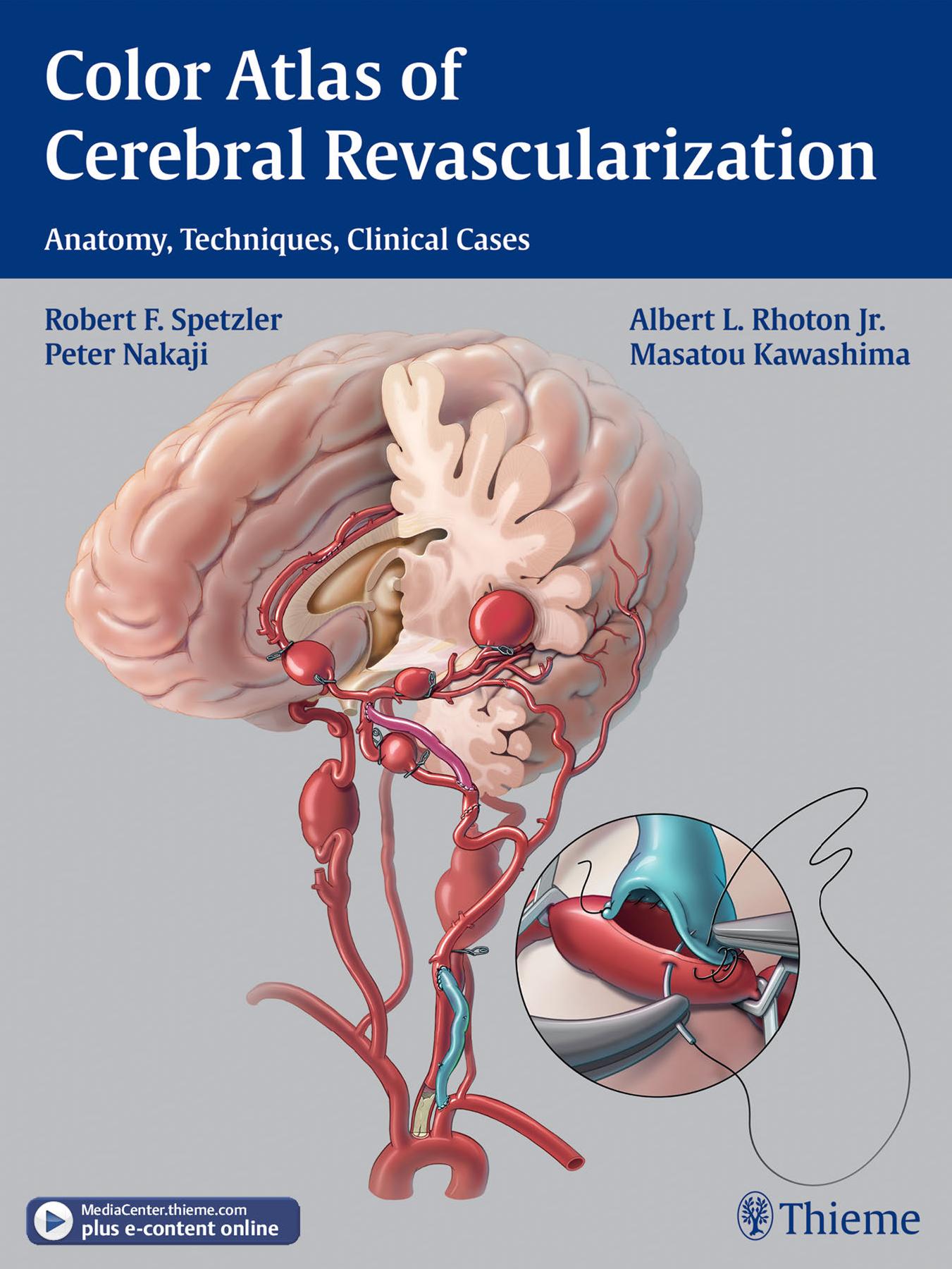 Color atlas of cerebral revascularization anatomy, techniques, clinical cases ; [DVD incl.] by Robert F. Spetzler Albert L. Rhoton Peter Nakaji Masatou Kawashima