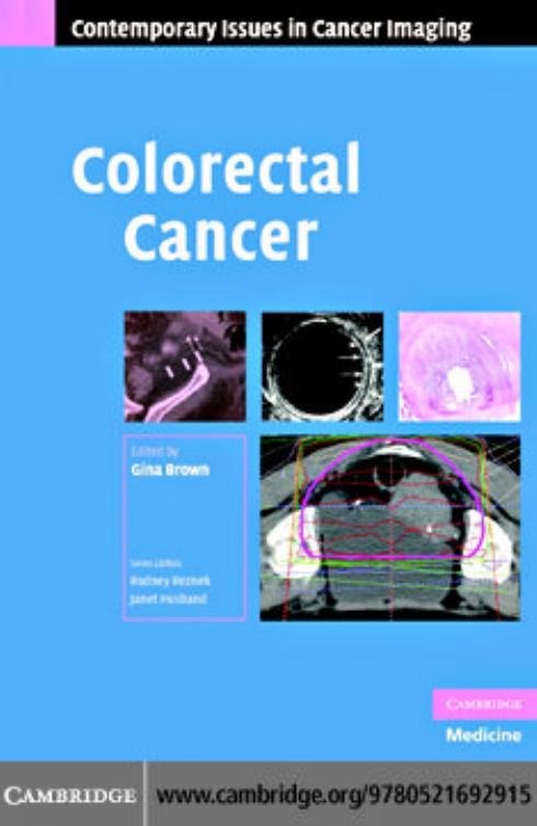 Colorectal Cancer (Contemporary Issues in Cancer Imaging) by Gina Brown