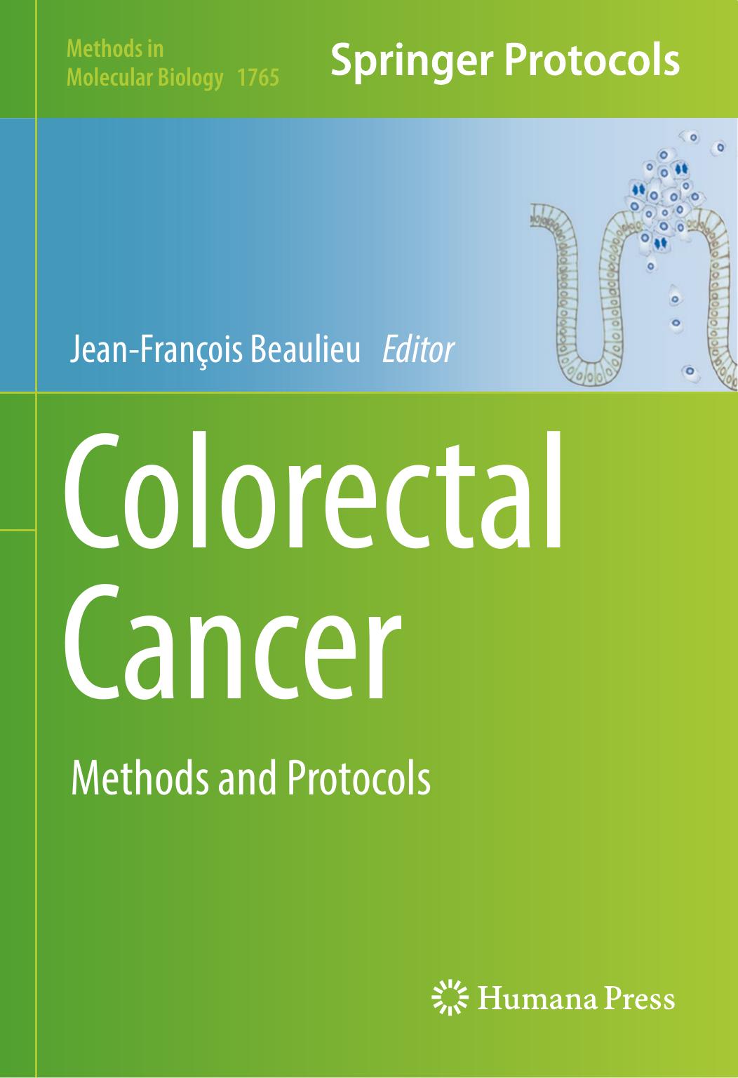 Colorectal Cancer by Jean-François Beaulieu