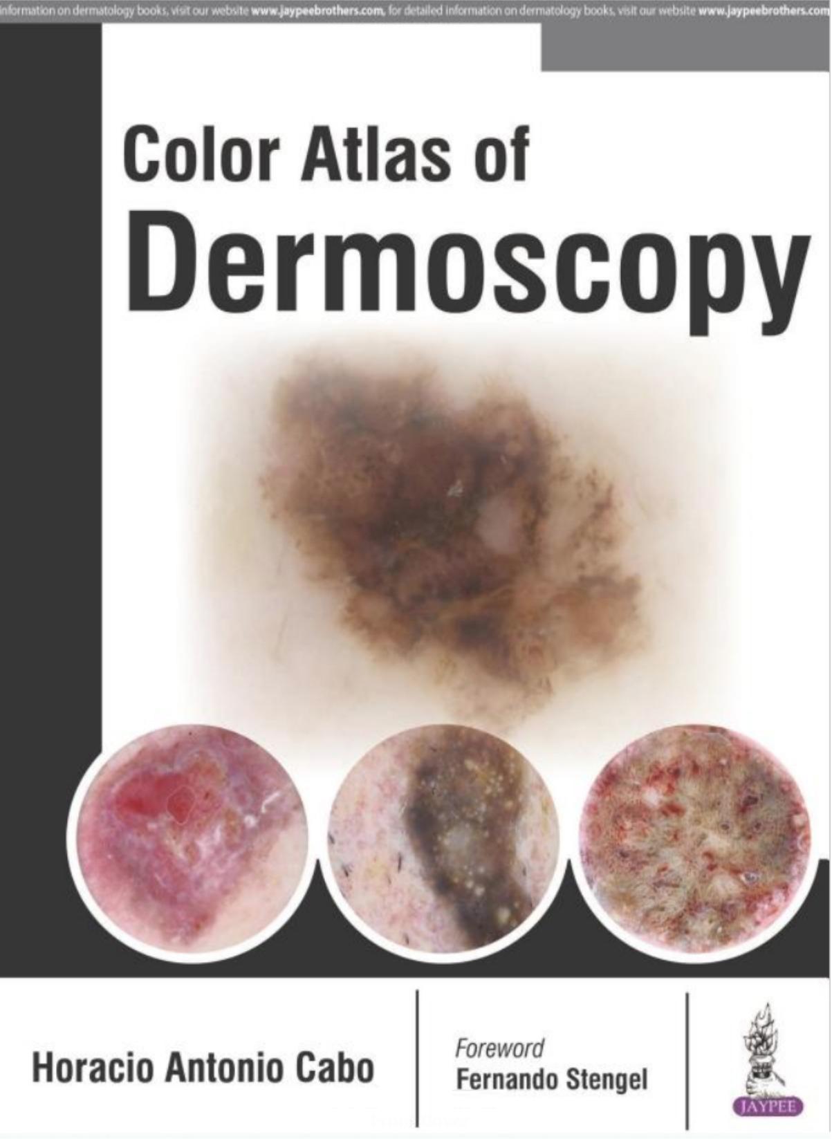 Colour Atlas of Dermoscopy by Horacio Antonio (Author) M.D. (Author) Ph.D. Cabo (Author)