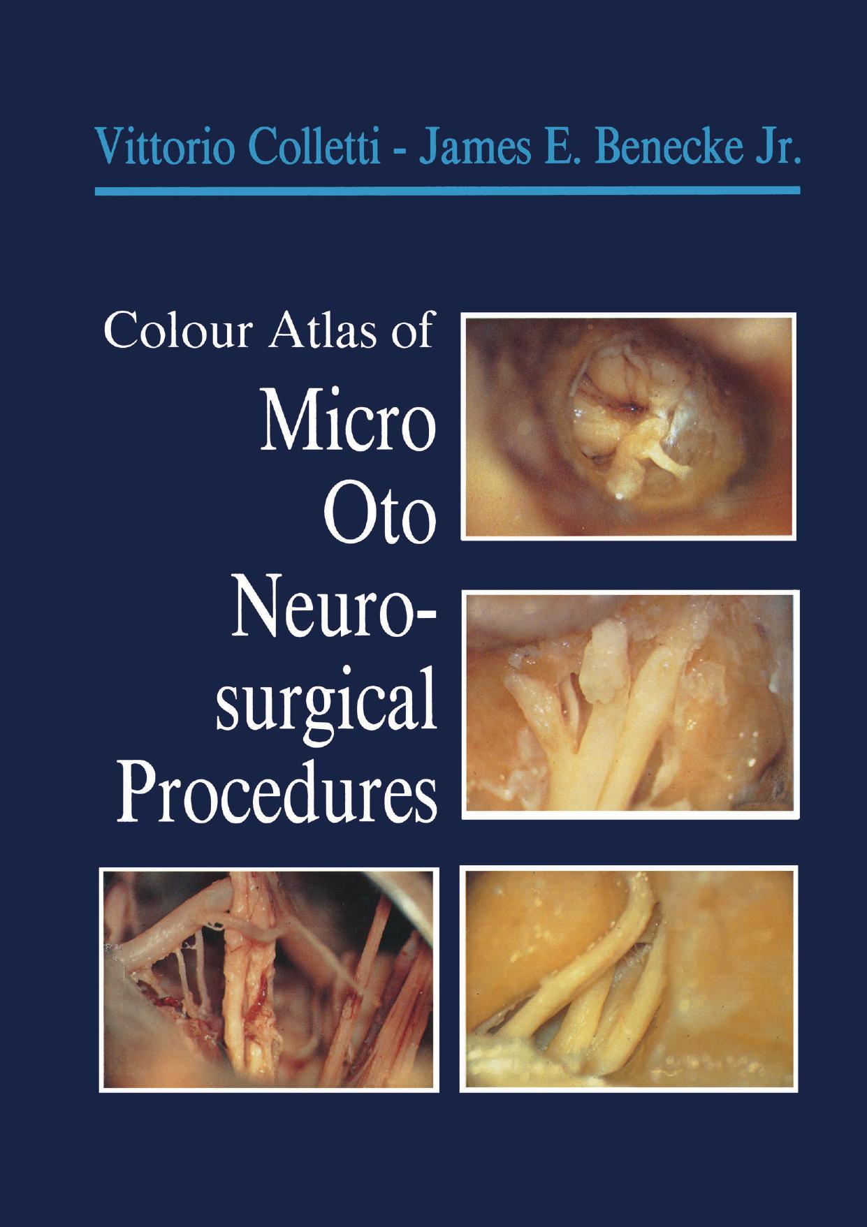 Colour Atlas of Micro-Oto-Neurosurgical Procedures by Vittorio Colletti M.D. James E. Benecke Jr. M.D. (auth.)
