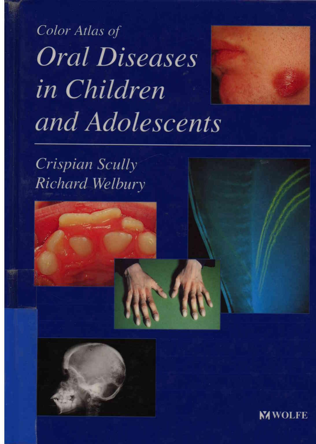 Colour Atlas of Oral Diseases in Children and Adolescence by Unknown
