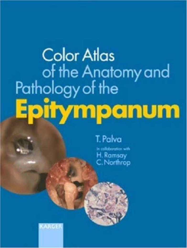 Colour Atlas of the Anatomy and Pathology of the Epitympanum by T. Palva Hans Ramsay Clarinda Northrop