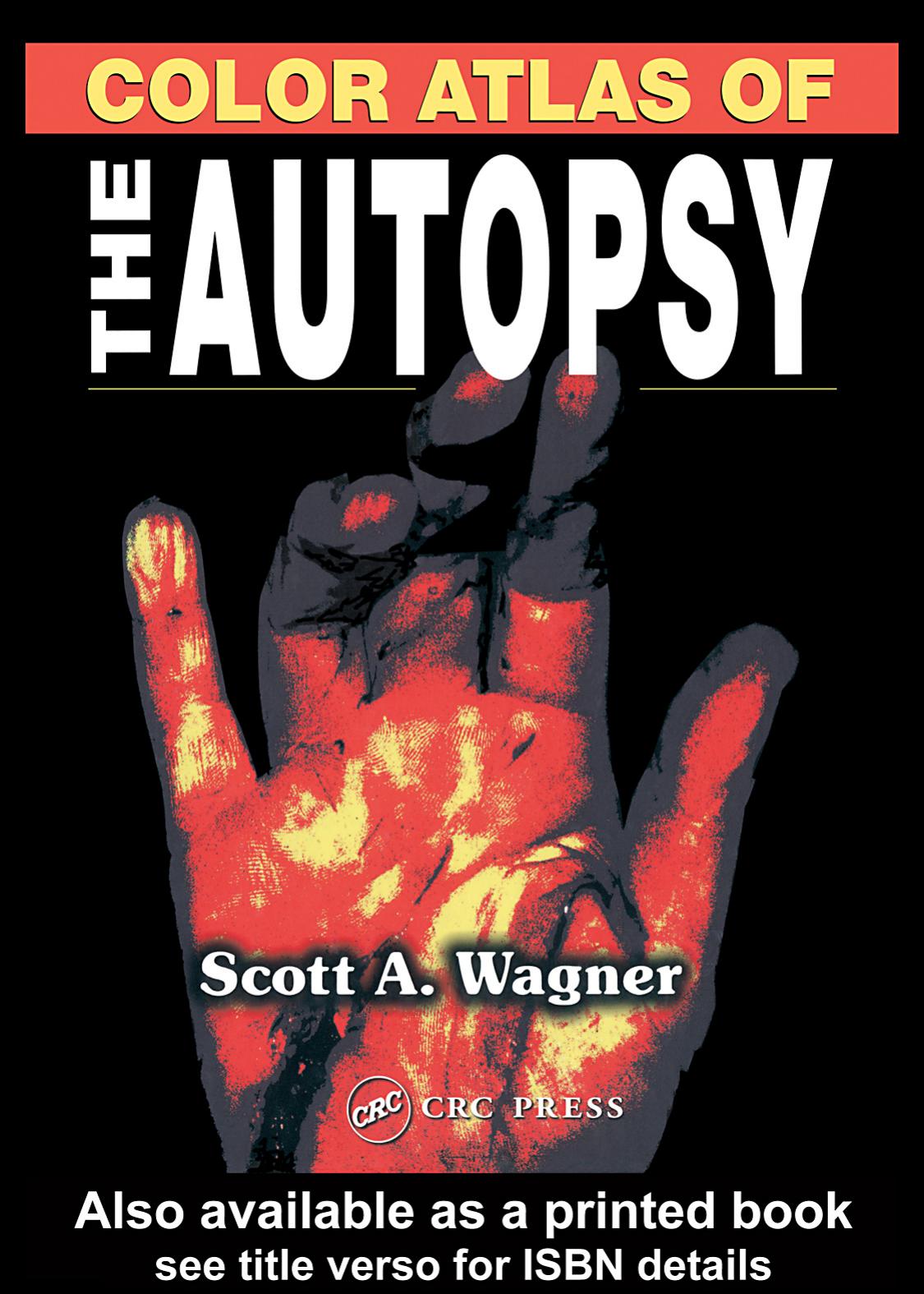 Colour Atlas of the Autopsy by Scott A.Wagner