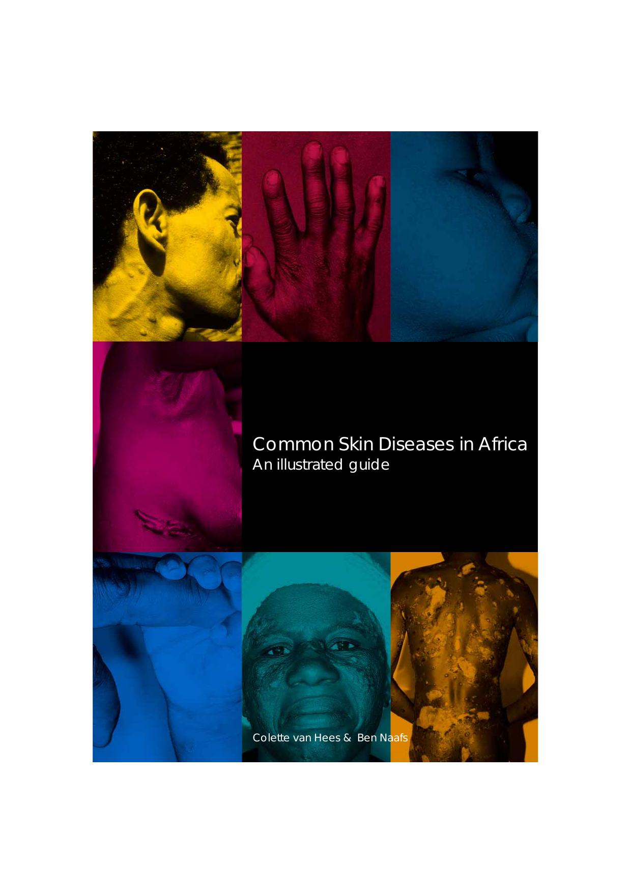Common Skin Diseases in Africa : an Illustrated Guide by Colette van Hees & Ben Naafs