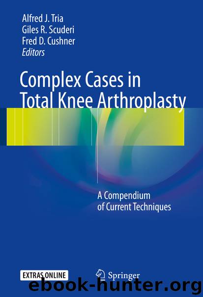 Complex Cases in Total Knee Arthroplasty by Alfred J. Tria Giles R. Scuderi & Fred D. Cushner