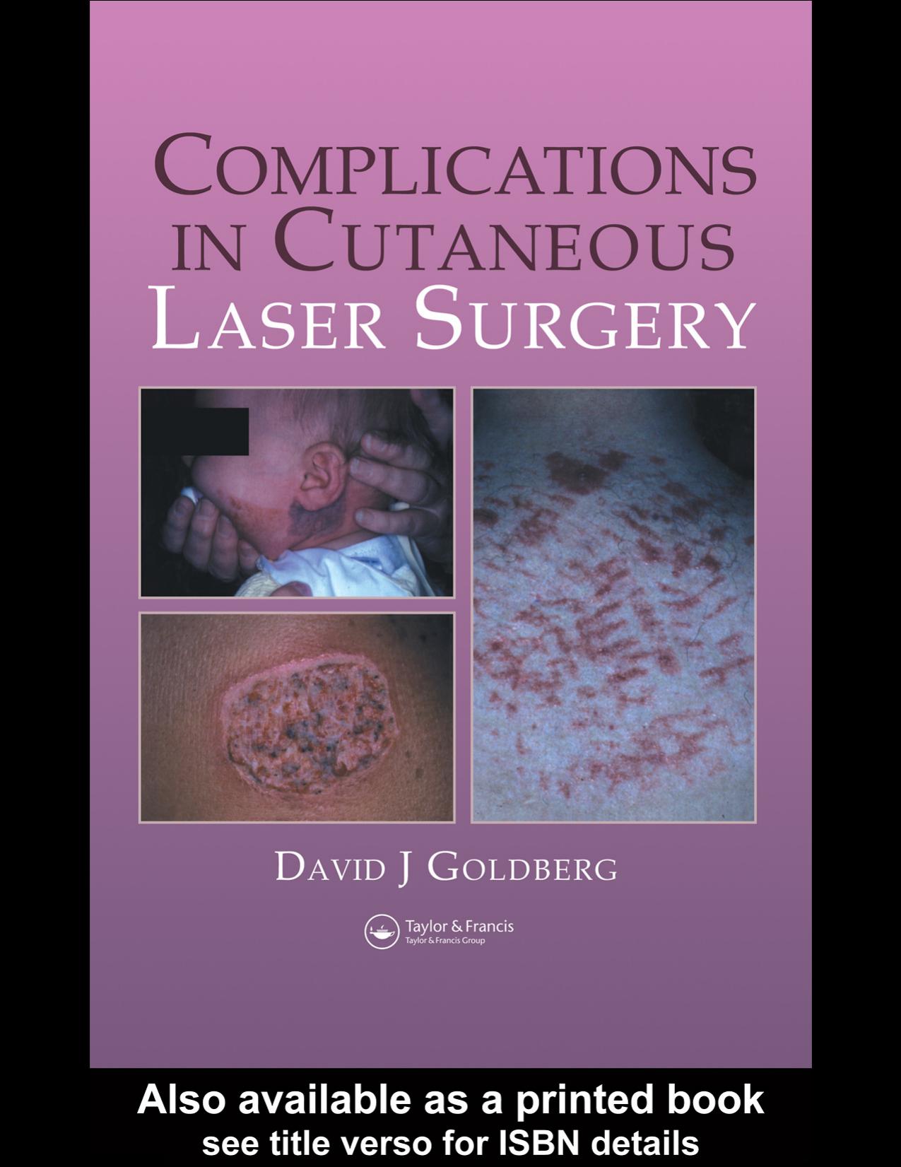 Complications in Laser Cutaneous Surgery by David J. Goldberg