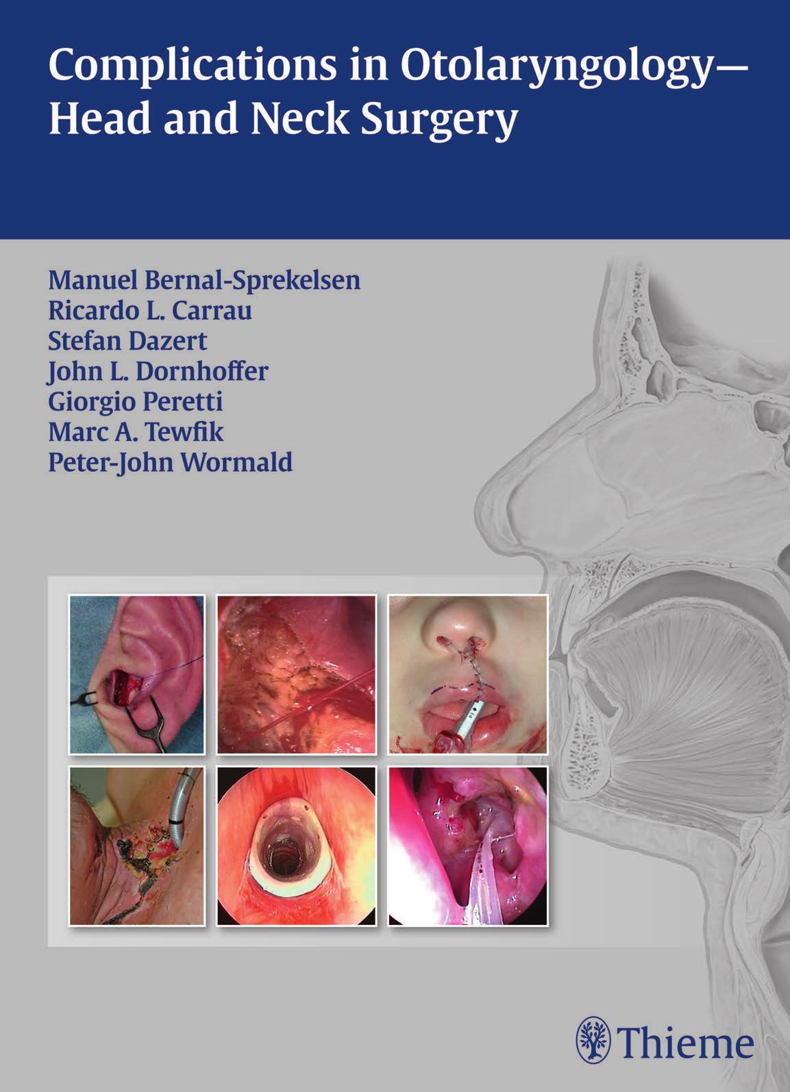 Complications in otolaryngology-- : head and neck surgery by unknow