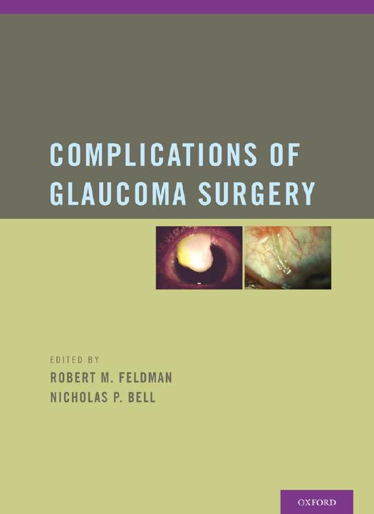 Complications of Glaucoma Surgery by Robert M. Feldman; Nicholas P. Bell