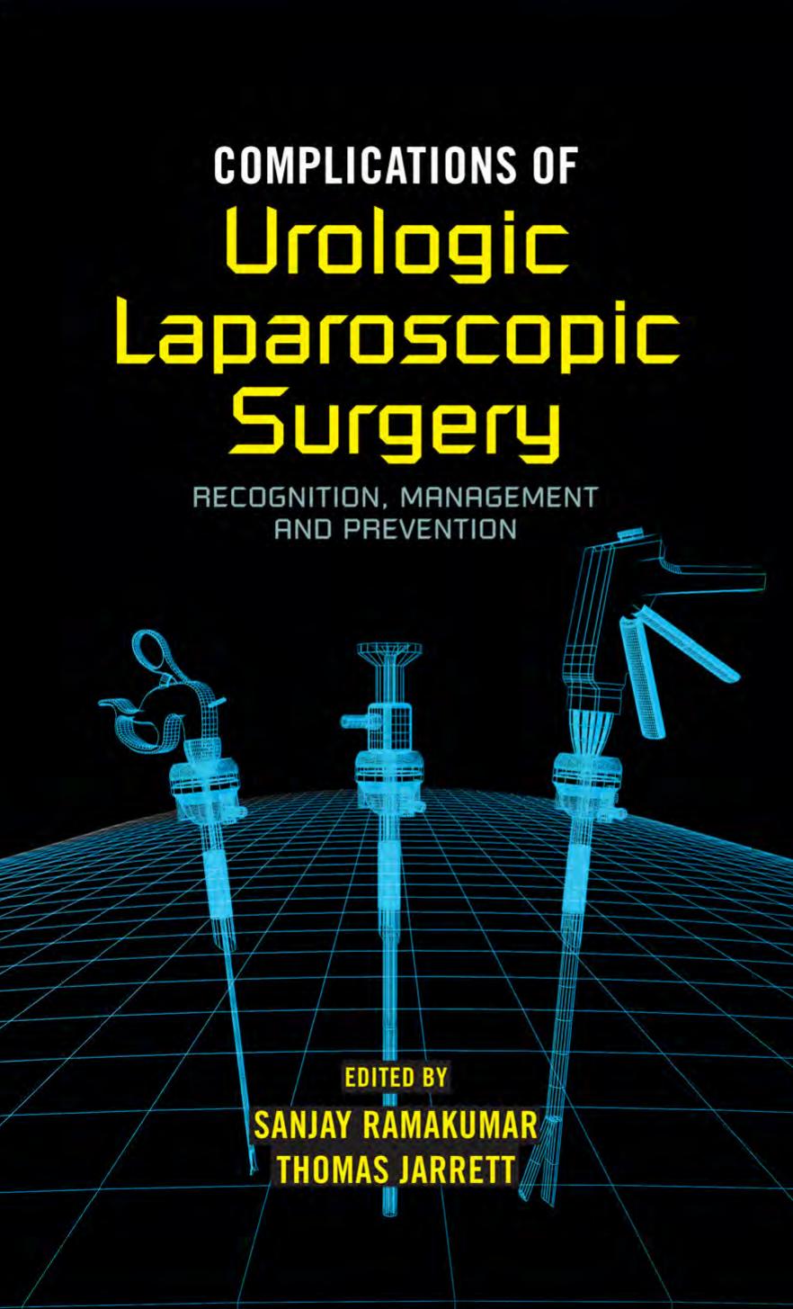 Complications of Urologic Laparoscopic Surgery by Sanjay Ramakumar Thomas W. Jarrett