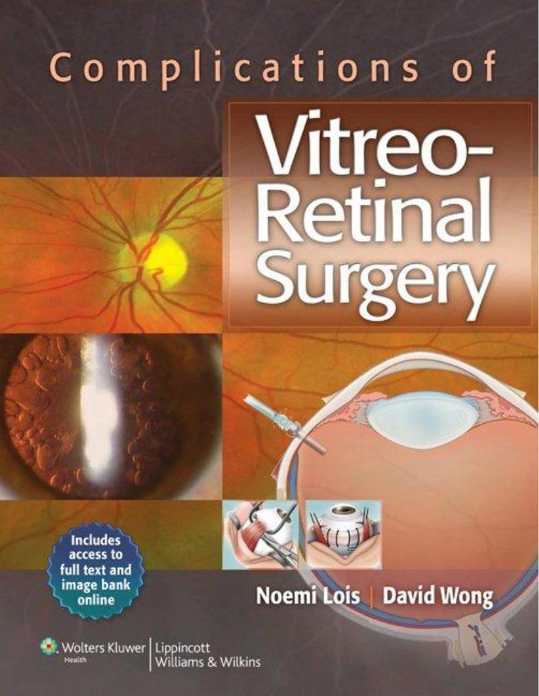 Complications of Vitreo-Retinal Surgery by Noemi Lois MD PhD FRCS(Ed) David Wong MD