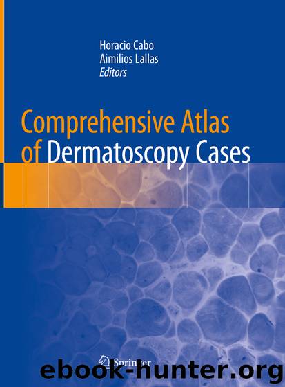 Comprehensive Atlas of Dermatoscopy Cases by Unknown