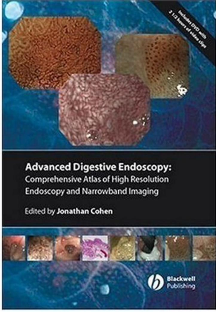 Comprehensive Atlas of High Resolution Endoscopy and Narrowband Imaging by Jonathan Cohen