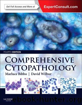 Comprehensive Cytopathology: Expert Consult: Online by Marluce Bibbo & David Wilbur