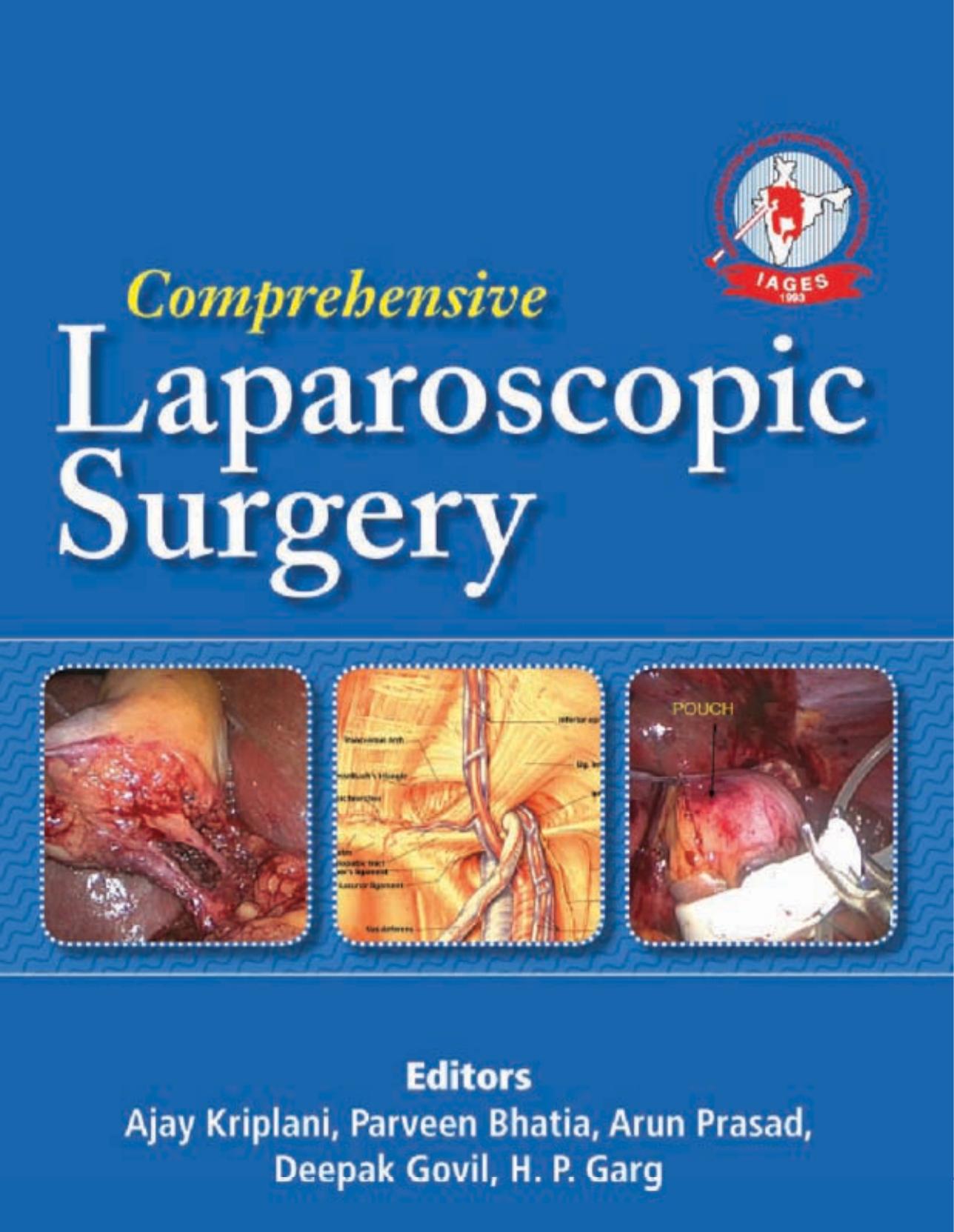 Comprehensive Laparoscopic Surgery by Ajay Kriplani Parveen Bhatia Arun Prasad Deepak Govil H. P. Garg