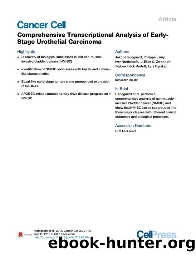 Comprehensive Transcriptional Analysis of Early-Stage Urothelial Carcinoma by unknow