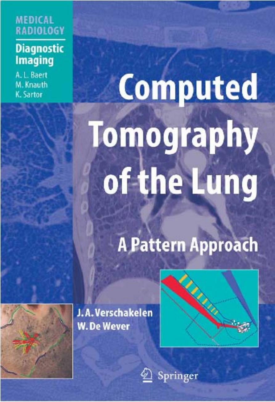 Computed Tomography of the Lung A Pattern Approach by Johny A. Verschakelen Walter de Wever A.L. Baert