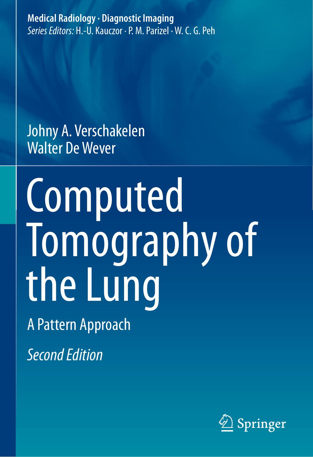 Computed Tomography of the Lung: A Pattern Approach by Johny A. Verschakelen Walter De Wever (auth.)