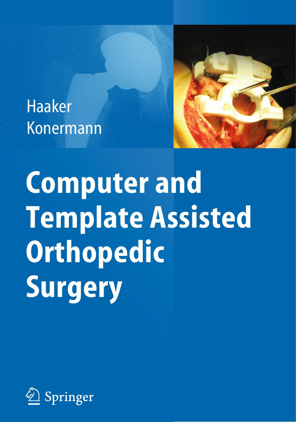 Computer and Template Assisted Orthopedic Surgery by Prof. Dr. Rolf Haaker (auth.) Prof. Dr. med. Rolf Haaker Prof. Dr. med. Werner Konermann (eds.)
