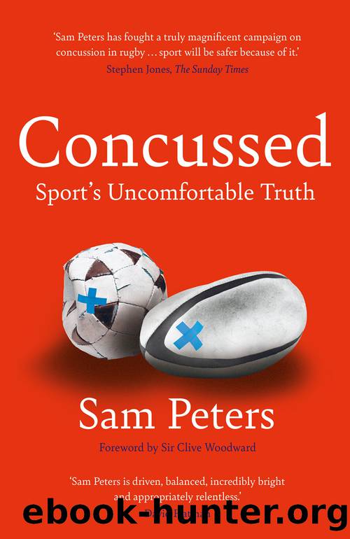 Concussed by Sam Peters
