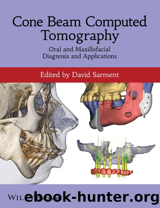 Cone Beam Computed Tomography by Oral & Maxillofacial Diagnosis & Applications