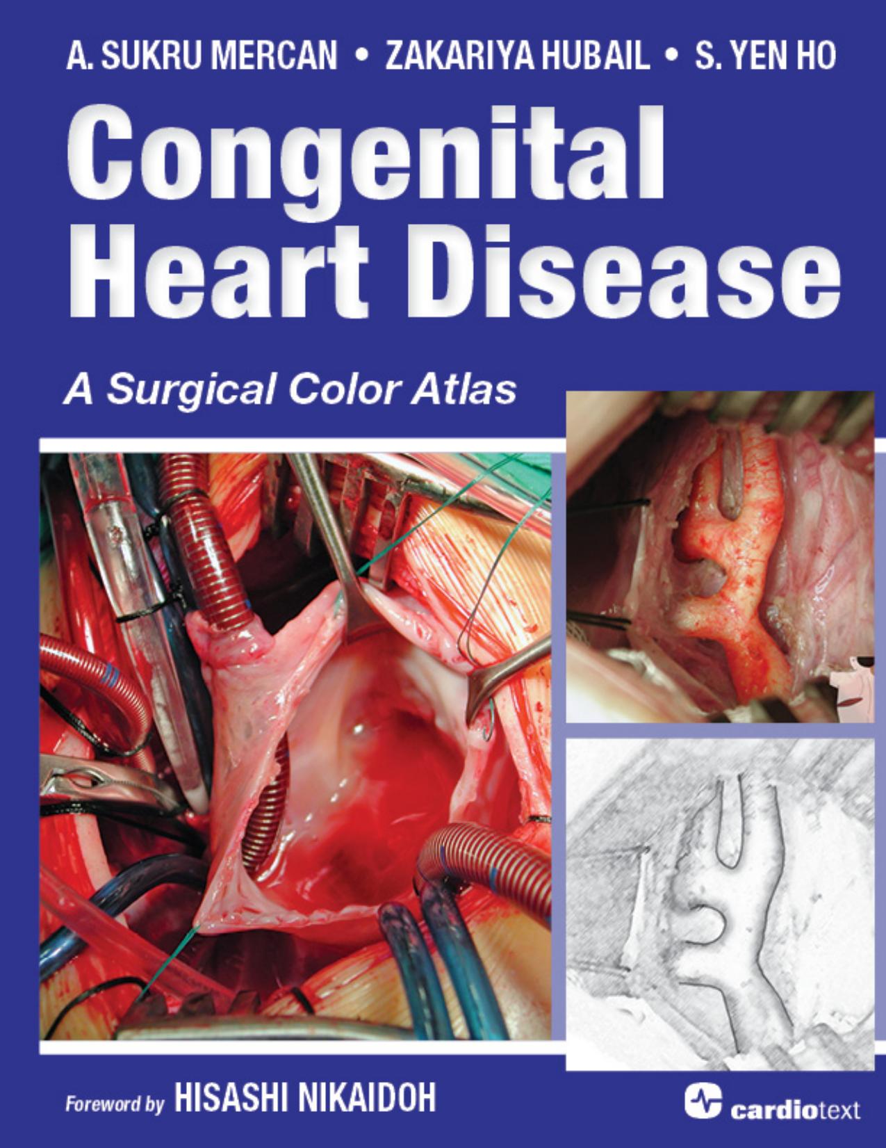 Congenital Heart Disease: A Surgical Color Atlas by A. Sukru Mercan Zakariya Hubail S. Yen Ho