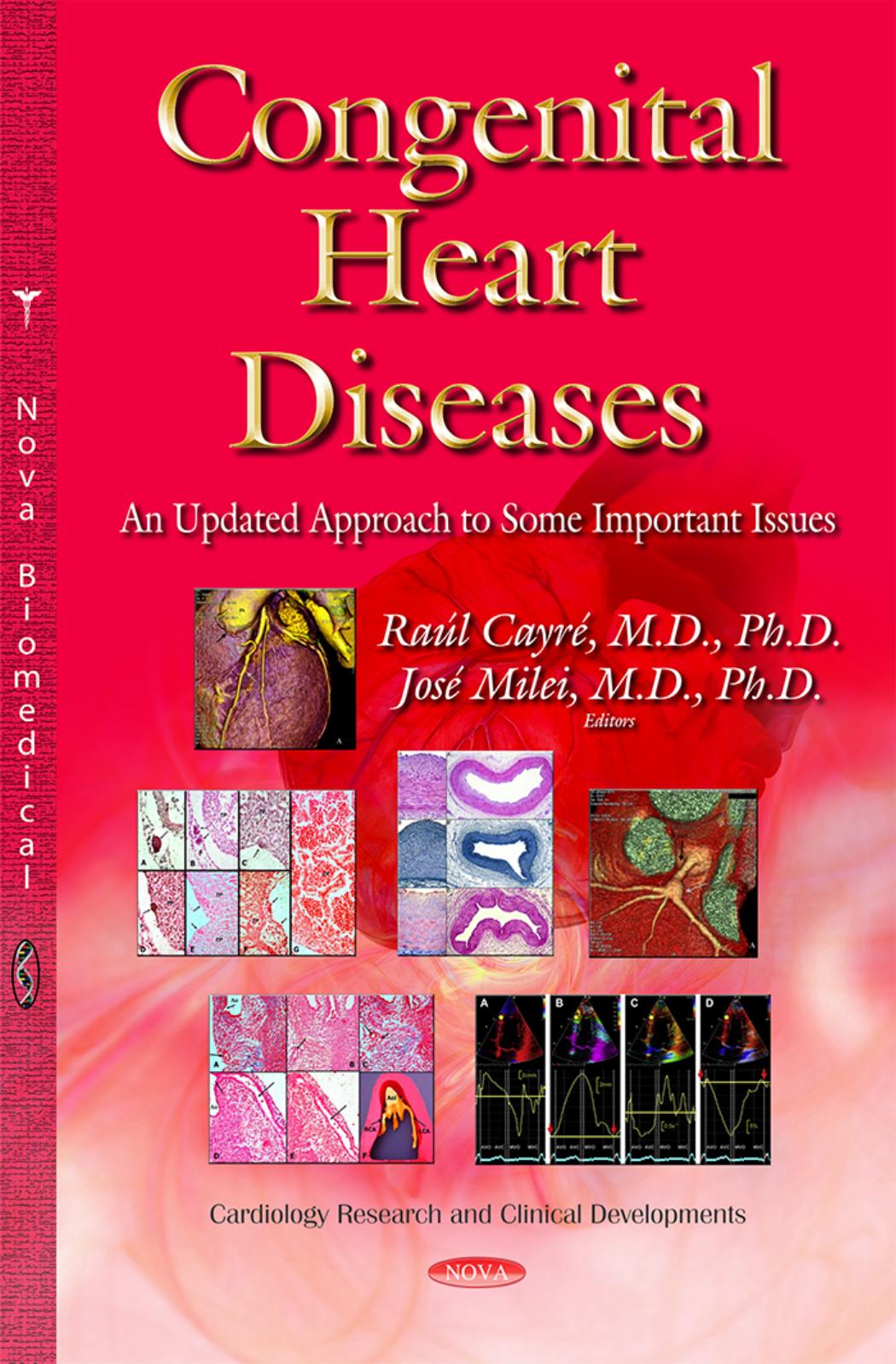 Congenital Heart Diseases: An Updated Approach to Some Important Issues by Raúl Cayré José Milei