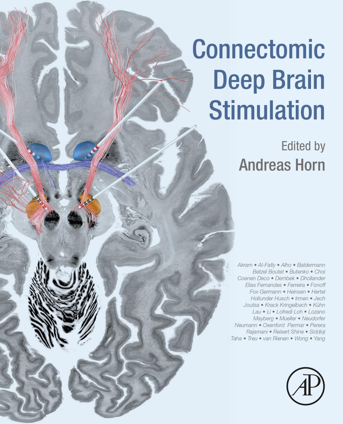 Connectomic Deep Brain Stimulation by Andreas Horn (editor)