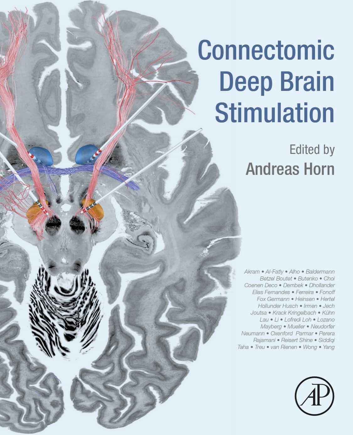 Connectomic Deep Brain Stimulation by Andreas Horn