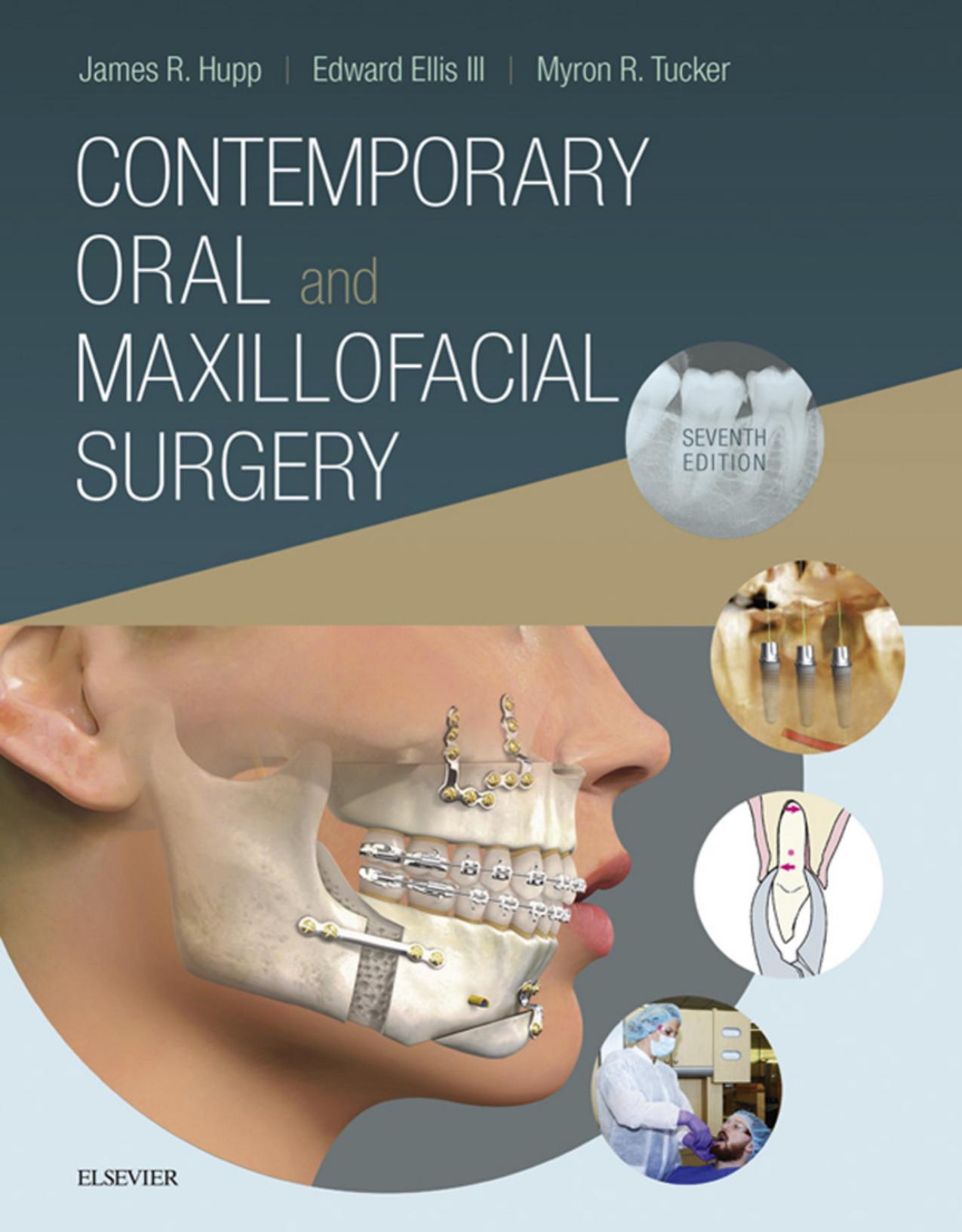 Contemporary Oral and Maxillofacial Surgery by James Hupp Myron Tucker Edward Ellis