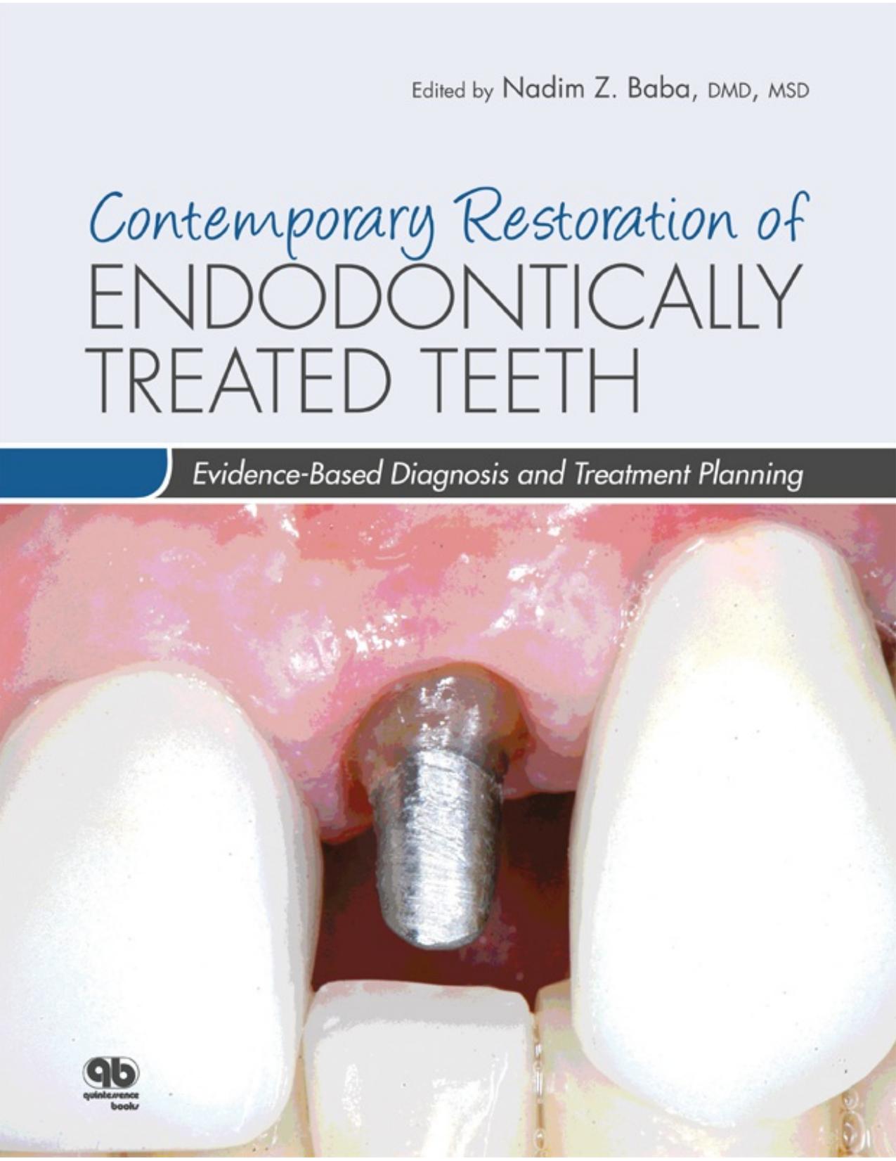 Contemporary Restoration of Endodontically Treated Teeth: Evidence-Based Diagnosis and Treatment Planning by Nadim Z Baba