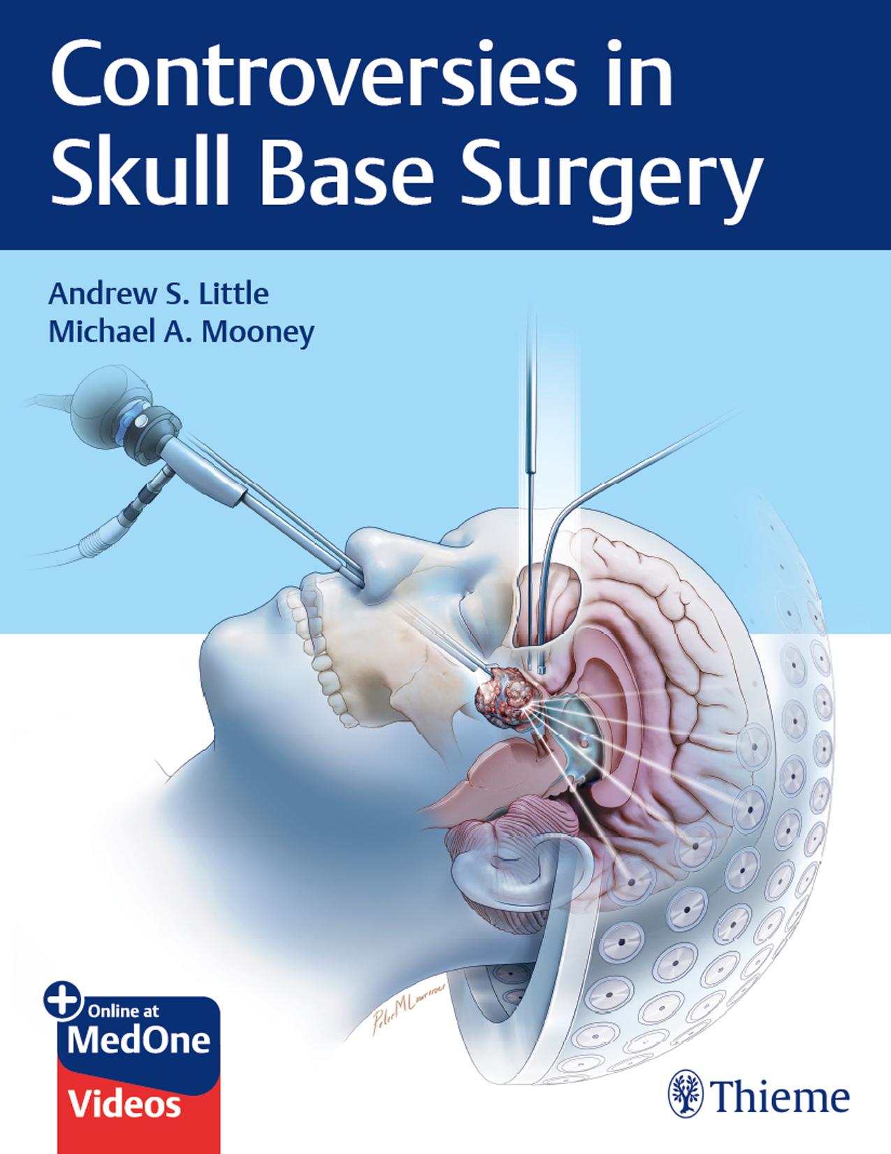 Controversies in Skull Base Surgery by Andrew S. Little; Michael A. Mooney