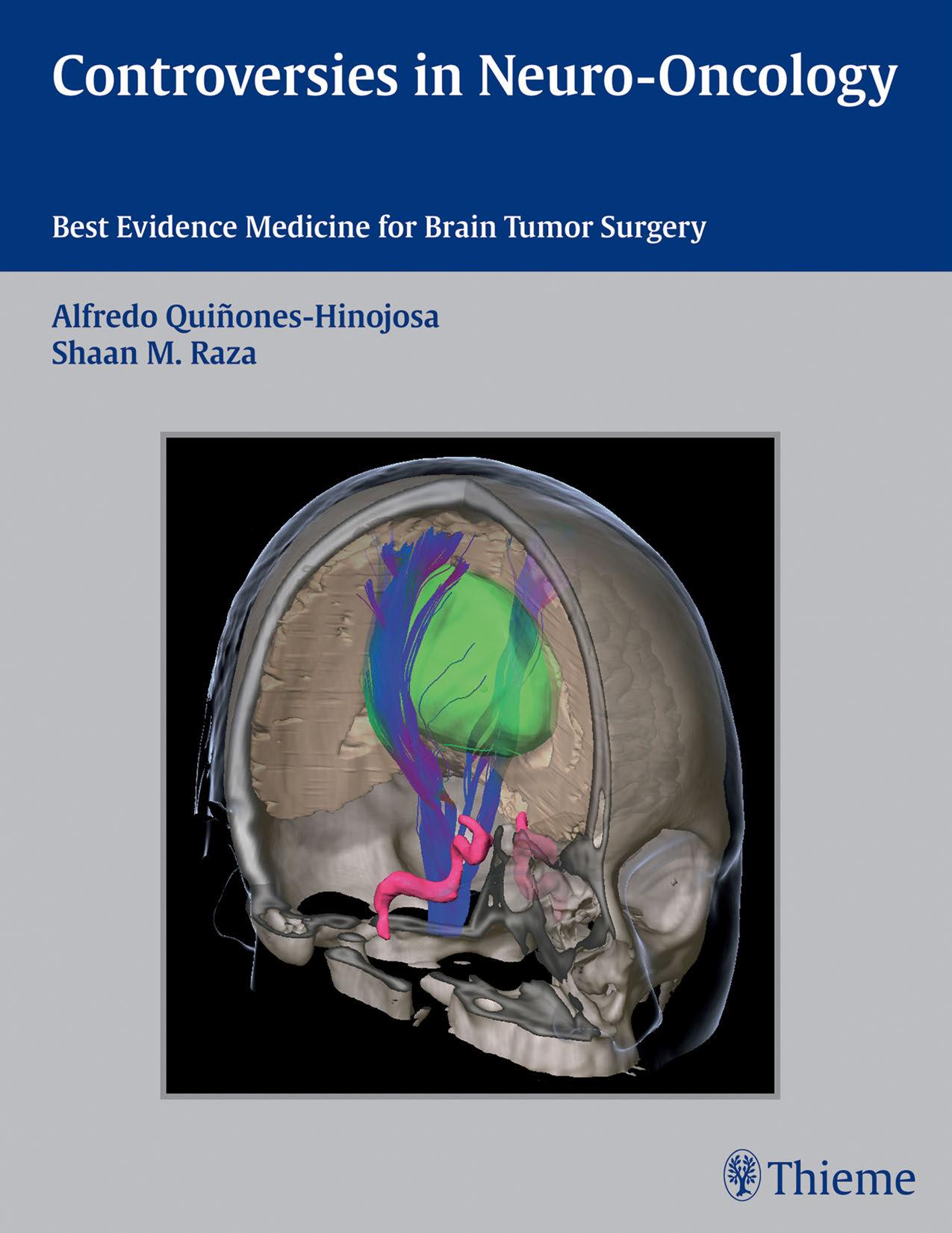 Controversies in neuro-oncology : best-evidence medicine for brain tumor surgery by Quiñones-Hinojosa Alfredo; Raza Shaan M