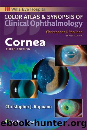 Cornea by Rapuano Christopher;